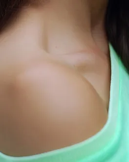 dermatología